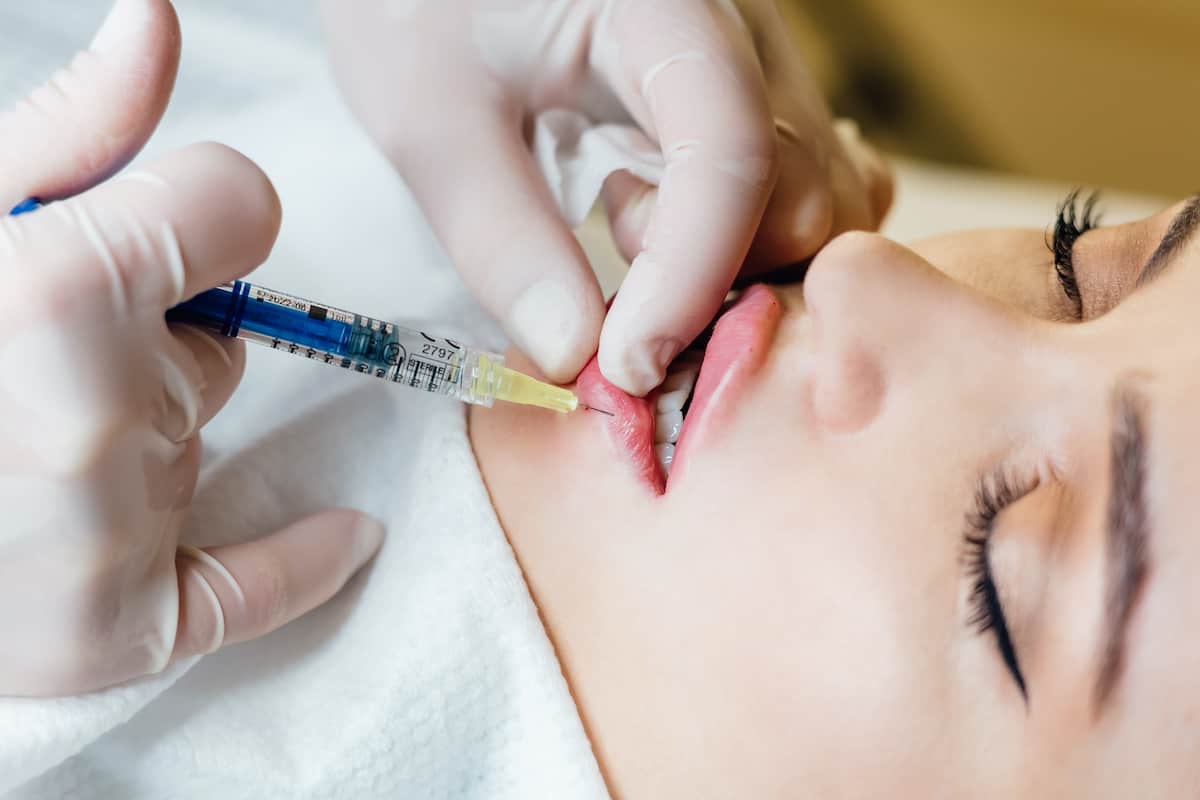 What Not To Do After Lip Injections